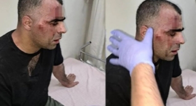 Öldüresiye dövüldü üstüne hapis cezası aldı