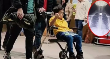 Bozuk para yuttu yemek borusuna takıldı