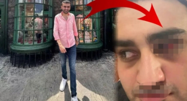 Gözünden yaralanan CZN Burak korkuttu