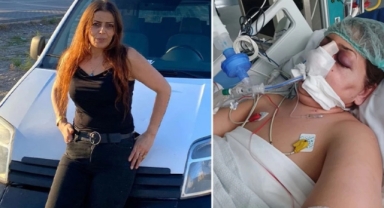 Burun estetiği ameliyatı 3 çocuk annesini öldürdü