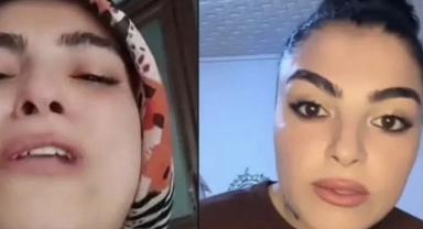 Çocuğu yaralıyken canlı yayın yapan kadına soruşturma