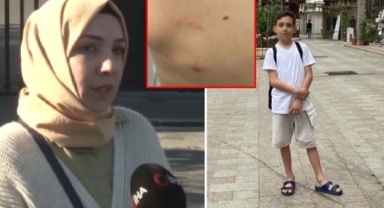 Okul müdürün beslediği 2 köpek öğrenciye saldırdı