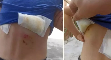  Sokak köpekleri 8 yaşındaki çocuğa saldırdı