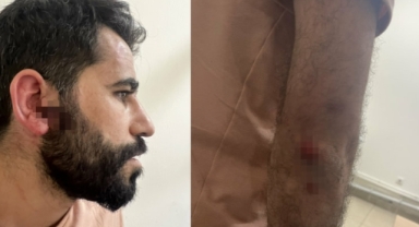 İstanbul Barosu'dan polis şiddeti açıklaması 