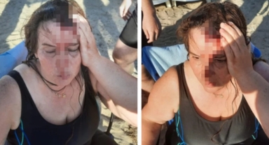 Denizde yüzerken kanlar içinde kaldı