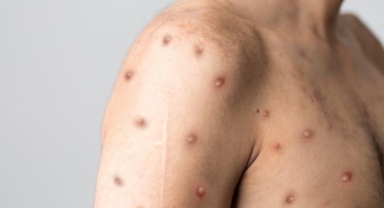 DSÖ’den korkutan açıklama