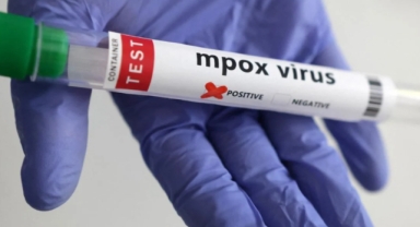 DSÖ'den salgın açıklaması