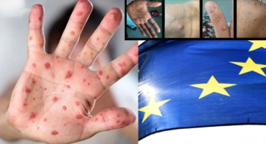 Maymun çiçeği sanıldığı kadar tehlikeli değil mi?