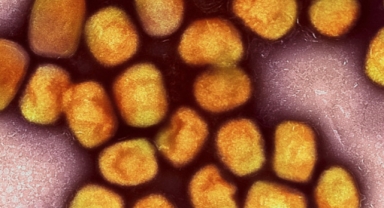 Maymun çiçeği tüm dünyayı tehdit ediyor