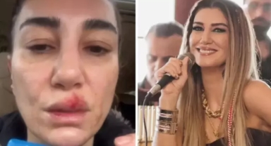 Nadide Sultan temizlik sırasında kaza geçirdi