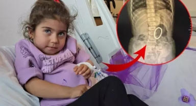 Küçük çocuğun bağırsaklarından çıkanlar şoke etti