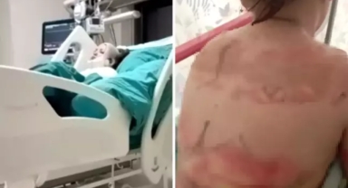 Okulda ısınırken vücudunun yarısı yandı