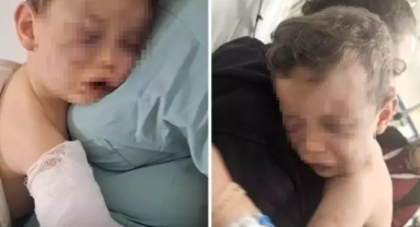 Öldüresiyle dövülen bebekle ilgili detaylar 