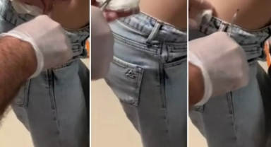 Sivilce sandı ama yakından bakınca hastaneye koştu