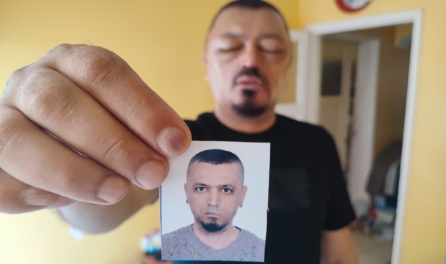 Adana’da Berber Tavsiyesiyle Alınan Saç Siyahlaştırıcı Şampuan Yüzde Yanıt: Göz ve Kafada Şişliklerle Yaralar Oluştu