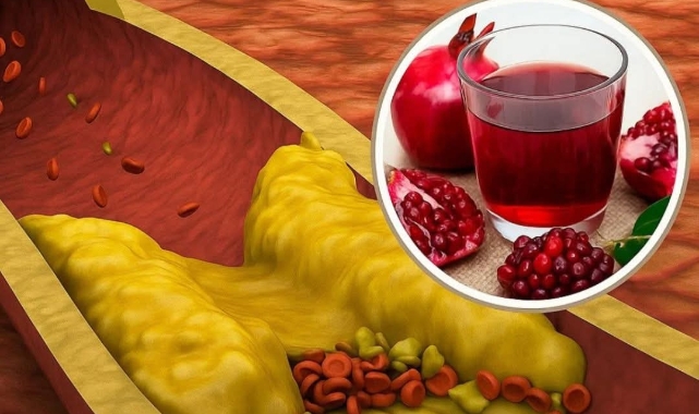 Nar Suyunun Gücü: Günde Bir Bardak Kalp Damarlarını %30’a Kadar Koruyabiliyor