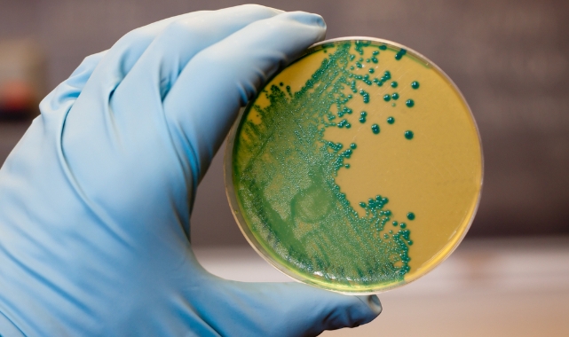 ABD’de Hazır Makarnadan Listeria Alarmı: 6 Ölü, 25 Hastanede