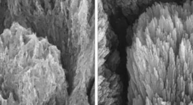 Diş Çürüklerine Ameliyatsız Çözüm: Protein Jeli Mineyi Kendini Onarmaya Zorluyor