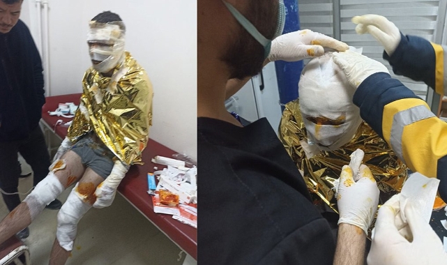 Erzurum Aşkale'de Kömür Ocağında Yangın: 2 İşçi Yaralandı