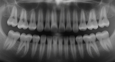 Japonya’da Dişlerin Doğal Olarak Yeniden Çıkmasını Sağlayan Çığır Açan Tedavi Denemeleri