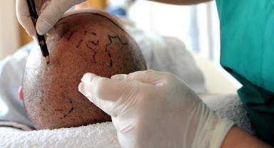 Saç Ekimi ve Diş Tedavisinin Ardından Turist Hayatını Kaybetti