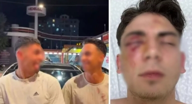 Konya'da Genci Muştalarla Kör Eden Saldırganlar Hakkında Flaş Karar!