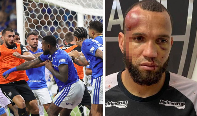 Brezilya Derbisinde Meydan Savaşı!